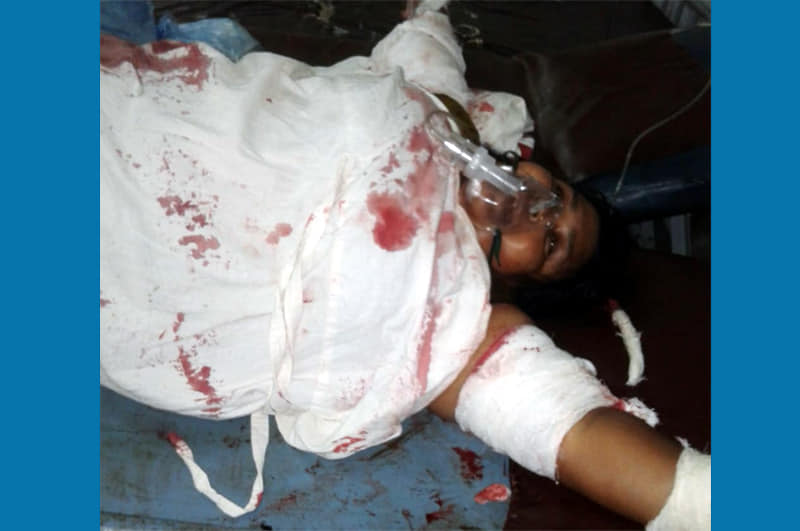 নগরীর পাঠানটুলায় সৎ মাকে কুপিয়ে জখম