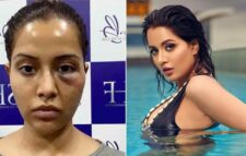 ত্বক চকচকের পরিবর্তে চেহারার বারোটা বেজেছে!