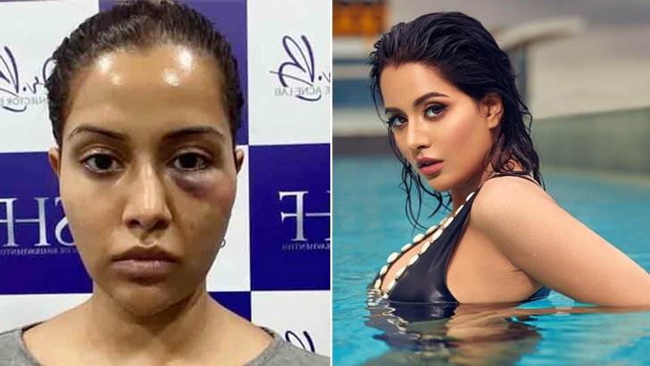 ত্বক চকচকের পরিবর্তে চেহারার বারোটা বেজেছে!