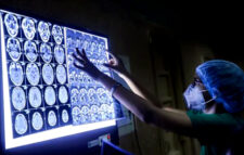 ব্ল্যাক ফাঙ্গাস’ কতটা ভয়ংকর?