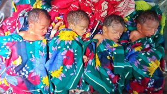 সিলেটে চার সন্তানের জন্ম দিলেন মমতা দেবী