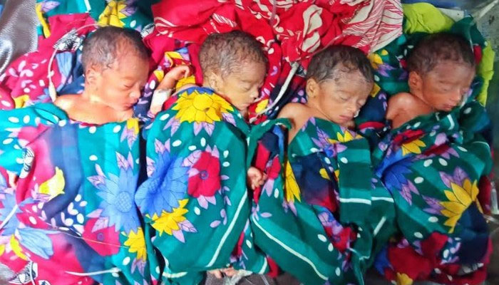 সিলেটে চার সন্তানের জন্ম দিলেন মমতা দেবী