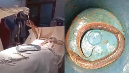 মাছ ধরতে গিয়ে পায়ূপথে ঢুকে যায় কুঁচিয়া, অস্ত্রোপচারে অপসারণ