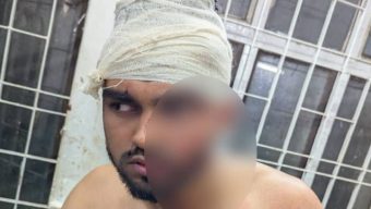 বৈষম্যবিরোধী ছাত্র আন্দোলনের সদস্যকে পিটিয়ে জখম