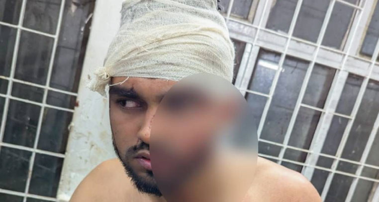 বৈষম্যবিরোধী ছাত্র আন্দোলনের সদস্যকে পিটিয়ে জখম