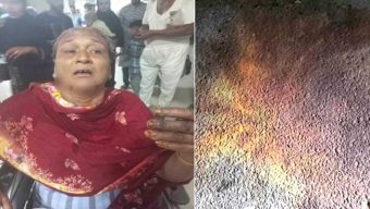 সিএনজি অটোরিকশায় ছোড়া পেট্রোল বোমায় দুই নারী দগ্ধ