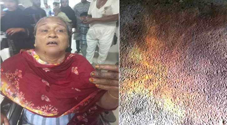 সিএনজি অটোরিকশায় ছোড়া পেট্রোল বোমায় দুই নারী দগ্ধ